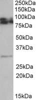 IHC-plus™ Polyclonal Goat anti-Human GPM6A / Glycoprotein M6A Antibody (aa59-70, IHC, WB)