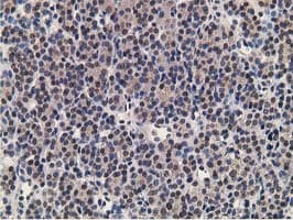 ADH2 / ADH1B Antibody (clone OTI4F12)