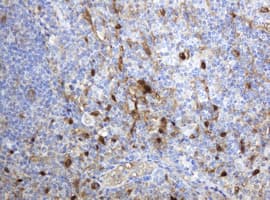 TP / Thymidine Phosphorylase Antibody (aa311-482, clone OTI1E7, Carrier-free)