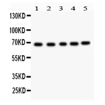 ACHE / Acetylcholinesterase Antibody (aa592-614)