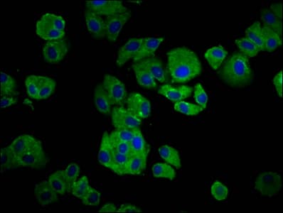 Kappa Light Chain Antibody