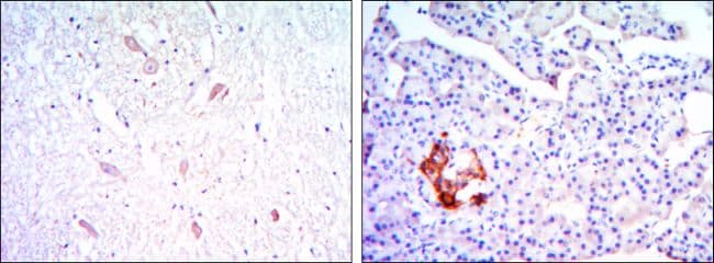 Monoclonal Mouse anti-Human KLHL13 Antibody (clone 8D1, IHC, IF, WB)