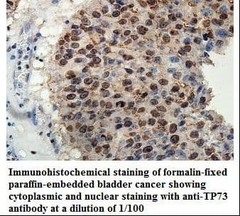 Polyclonal Rabbit anti-Human TP73 / p73 Antibody (aa420-633, IHC, WB)