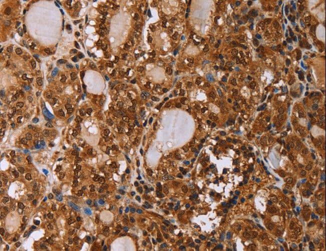 Polyclonal Rabbit anti-Human IHH Antibody (IHC)