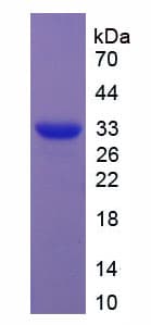 Mouse Alpha-Fetoprotein (Recombinant His-S)