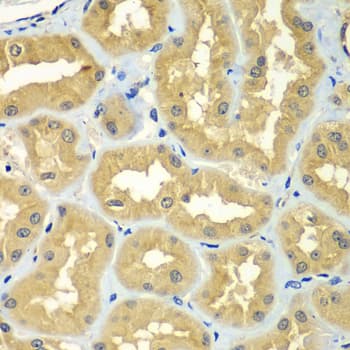 Polyclonal Rabbit anti-Human GOPC / PIST Antibody (IHC, IF, WB)
