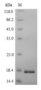 Human CACNA2D1 Protein (Recombinant 6His, N-terminus)