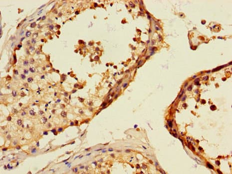 Polyclonal Rabbit anti-Human TLL1 Antibody (IHC, IF)