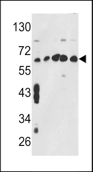 CCT3 Antibody (aa298-326)
