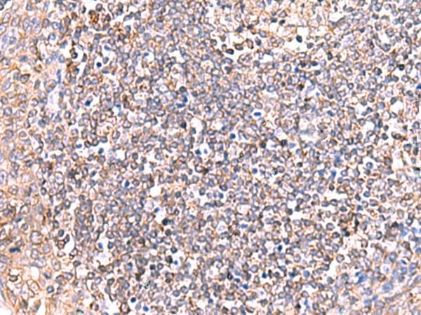 Polyclonal Rabbit anti-Human GRIA2 / GLUR2 Antibody (IHC)