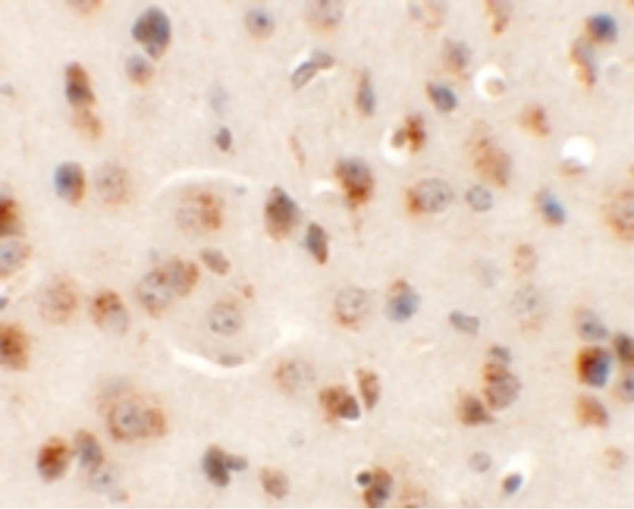 AP3M1 Antibody