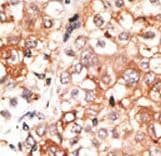 Polyclonal Rabbit anti-Human GJC1 / CX45 / Connexin 45 Antibody (aa89-120, IHC, WB)