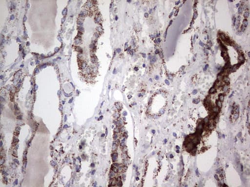 PIK3CD / PI3K Delta Antibody (aa286-610, clone OTI1D11)