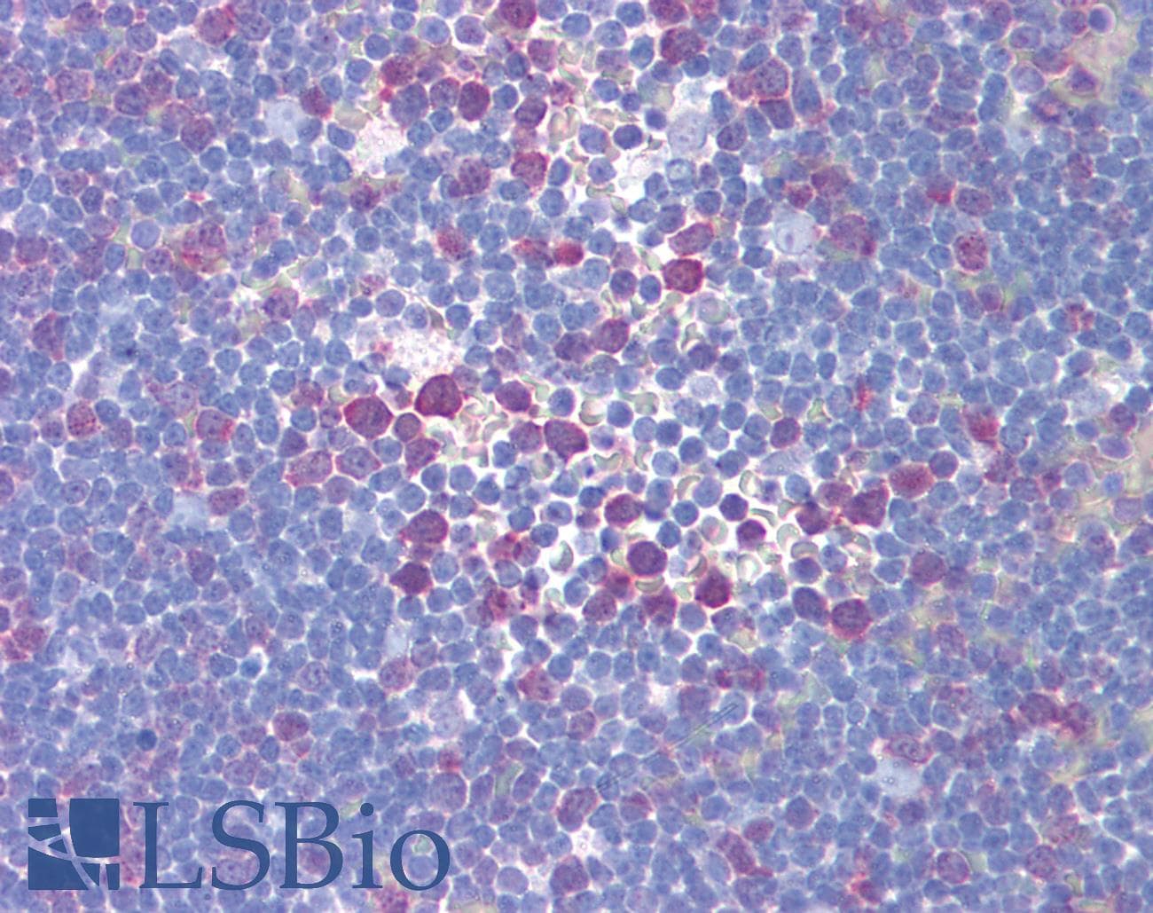 IHC-plus™ TS / Thymidylate Synthase Antibody
