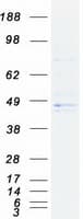 Human HSD3B1 Protein (Recombinant Myc-DDK (Flag))