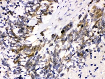 Polyclonal Rabbit anti-Human CDK4 Antibody (IHC, WB)