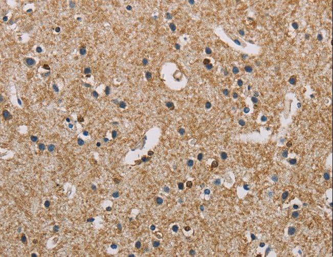 Polyclonal Rabbit anti-Human PIP4K2A / PIPK Antibody (IHC, WB)