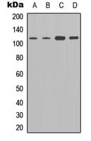 Polyclonal Rabbit anti-Human ADGRE2 / EMR2 Antibody (Internal, IF, WB)