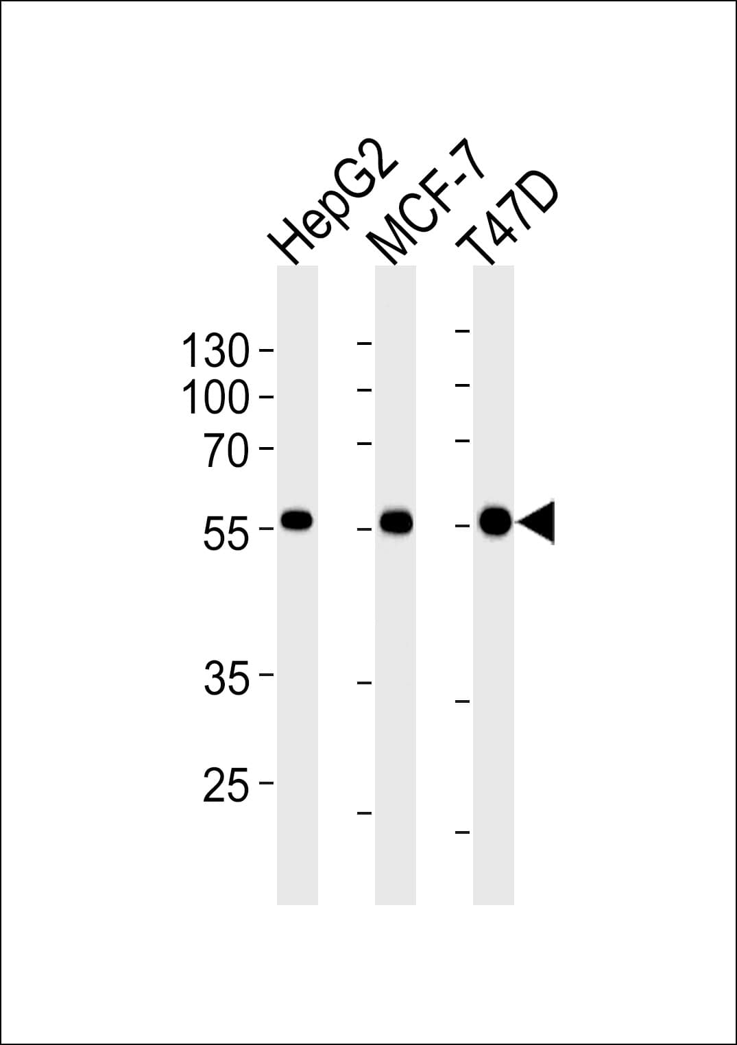 ALDH6A1 Antibody