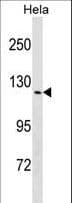 TRPV4 Antibody (aa160-189)