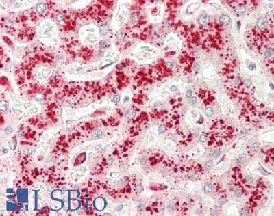 IHC-plus™ CTSZ / Cathepsin Z Antibody (Internal)