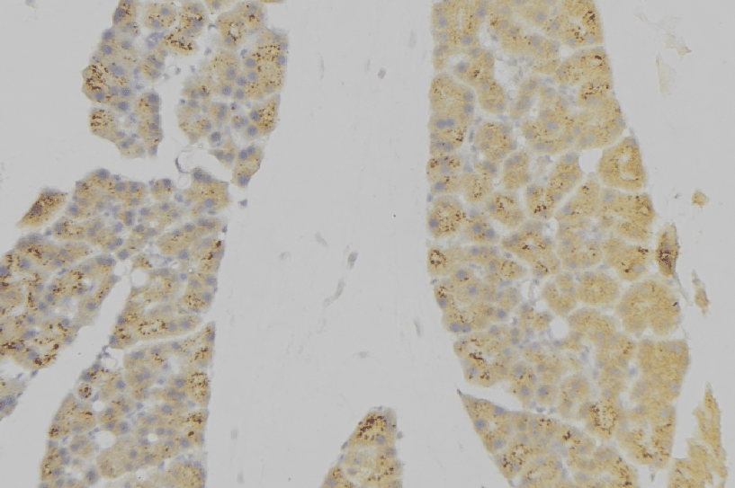 Polyclonal Rabbit anti-Human IL7R / CD127 Antibody (IHC, IF, WB)