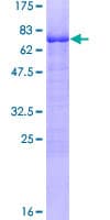 Human KLF15 Protein (Recombinant GST)