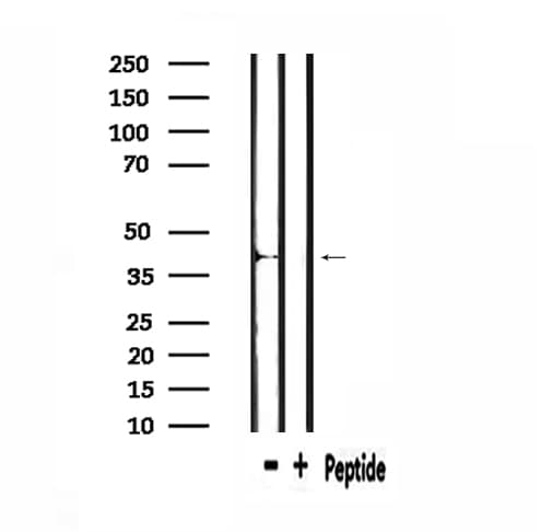 Polyclonal Rabbit anti-Human CYTB / MT-CYB Antibody (IHC, IF, WB)
