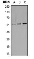 KRT14 / CK14 / Cytokeratin 14 Antibody (C-Terminus)