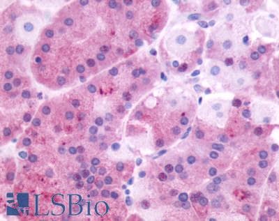PathPlus™ Polyclonal Rabbit anti-Human GRPR Antibody (Extracellular Domain, IHC, WB)