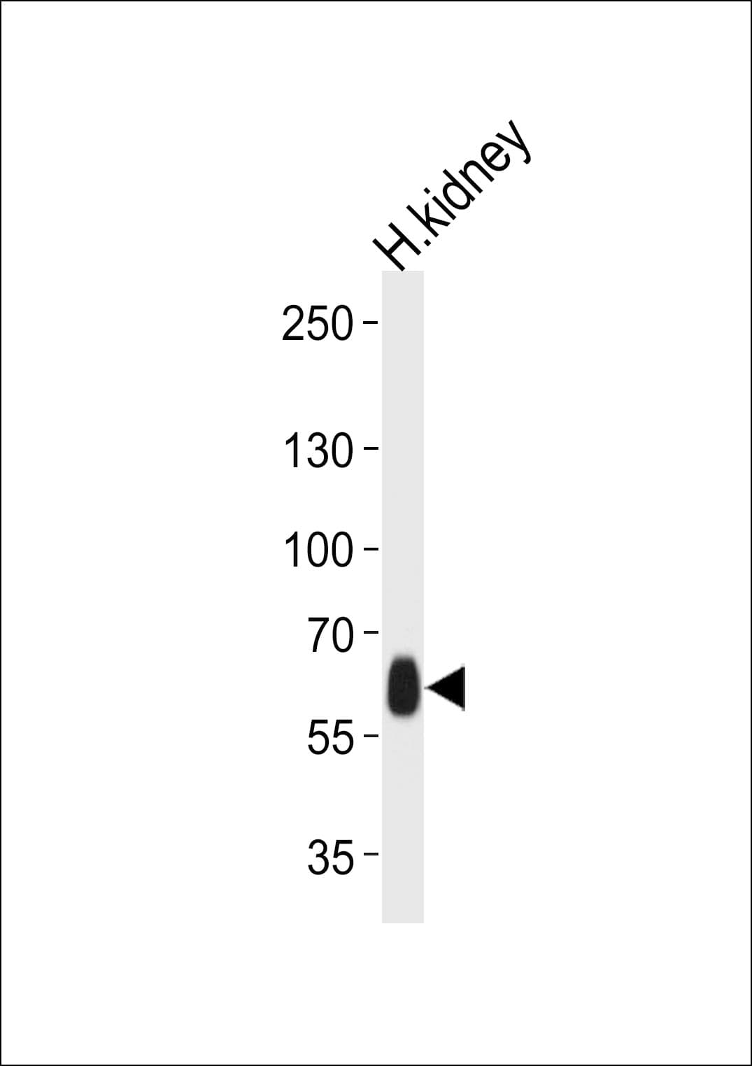 Polyclonal Rabbit anti-Human WHRN Antibody (aa378-406, IHC, WB)