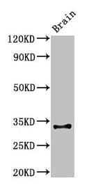 CD74 / CLIP Antibody