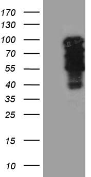 TBX3 Antibody (aa244-481, clone OTI8H5)