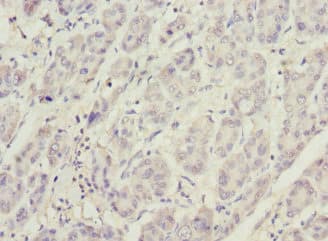 PHKG2 Antibody