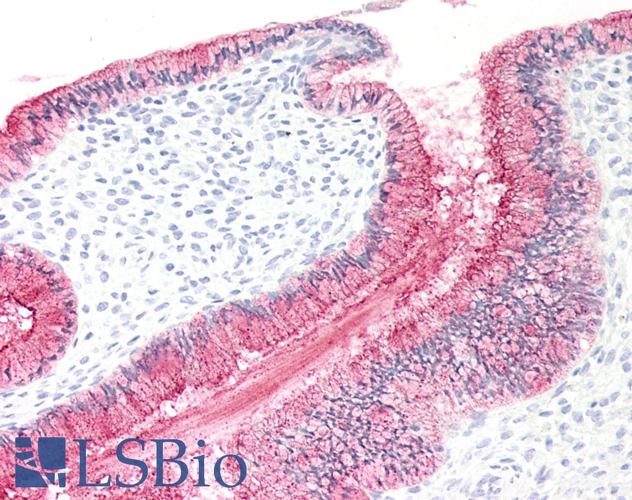 IHC-plus™ Monoclonal Mouse anti-Human MUC16 / CA125 Antibody (clone ABT-MUC16, IHC)