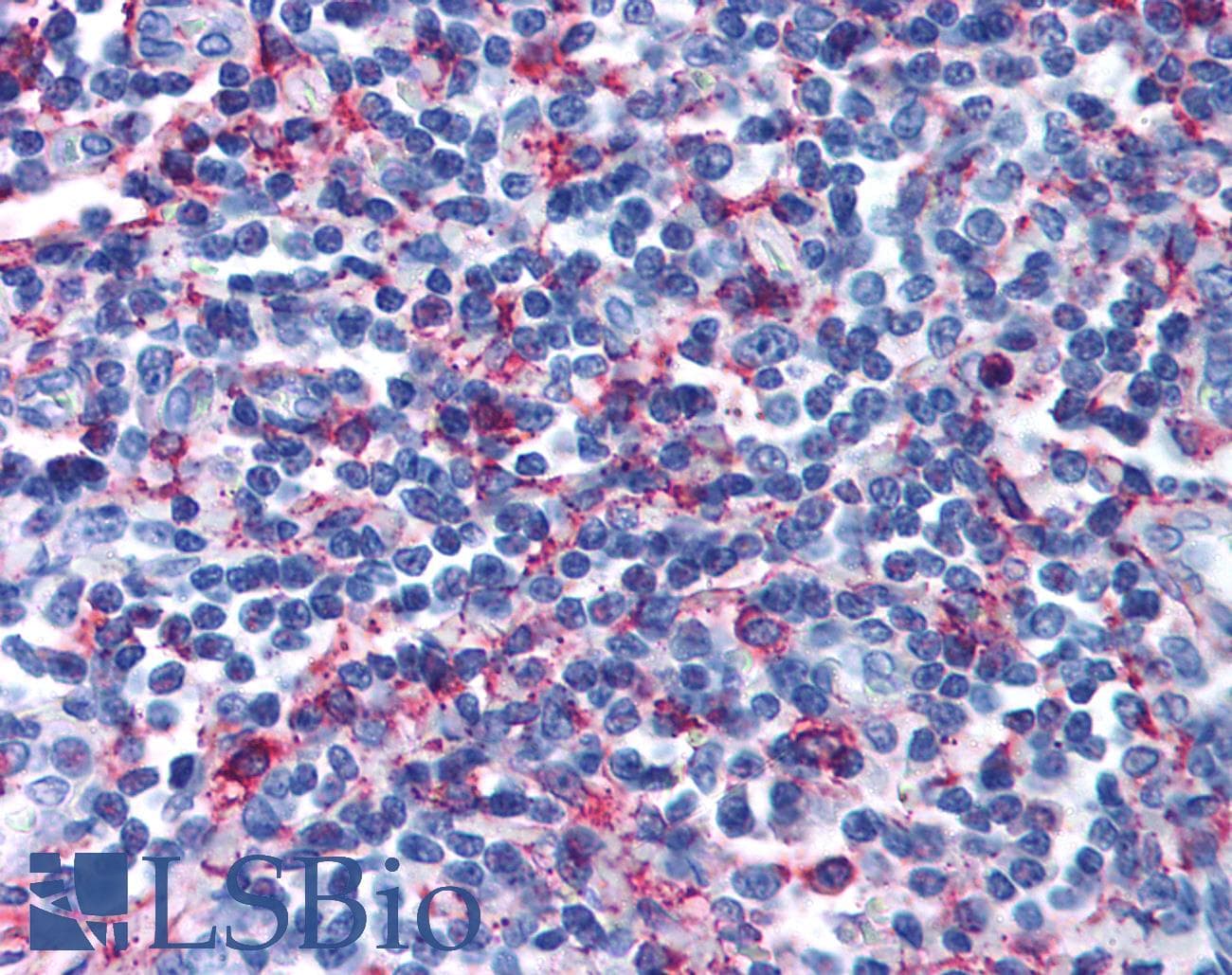 IHC-plus™ Polyclonal Rabbit anti-Human GPR44 / CRTH2 Antibody (Extracellular Domain, IHC)