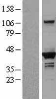 DHPS Protein (Over-Expression Lysate Myc-DDK (Flag))