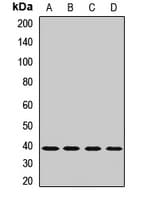 GYG1 / Glycogenin Antibody