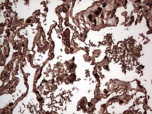 PKM2 Antibody (clone OTI12D5, Carrier-free)