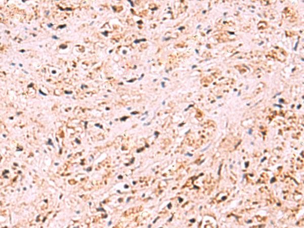 ZSWIM1 Antibody