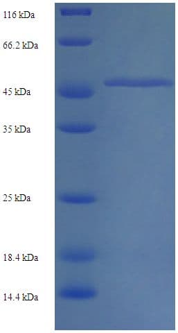 Human CASD1 Protein (Recombinant His-SUMO)