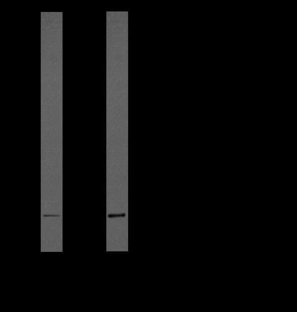 IL-1B / IL-1 Beta Antibody (clone 43N3D8)