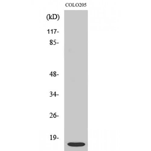 Polyclonal Rabbit anti-Human ATP5I Antibody (30-110 aa, Internal, IHC, WB)