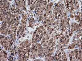 ADH2 / ADH1B Antibody (clone OTI3F2)