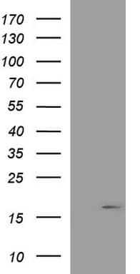 PLA2G16 / HRASLS3 Antibody (clone OTI1G1)