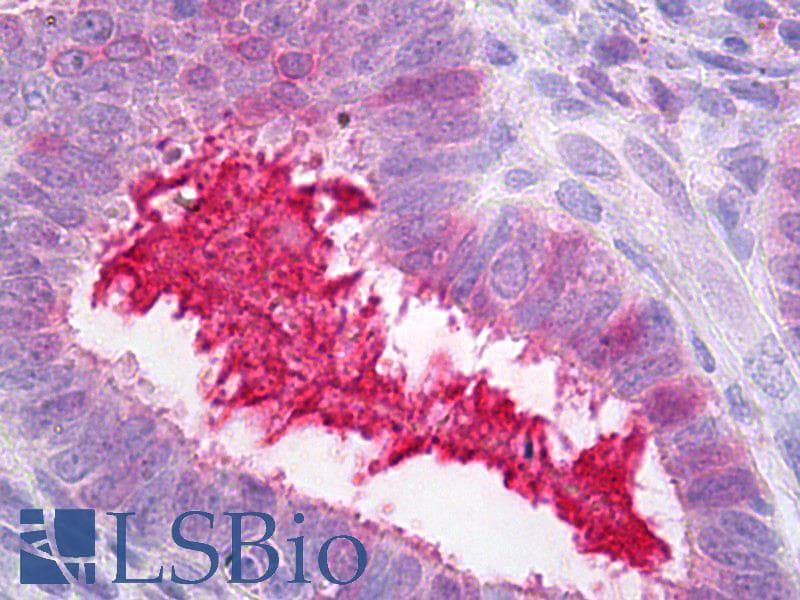 IHC-plus™ SERPING1 / C1 Inhibitor Antibody