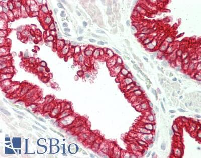 IHC-plus™ APLNR/ Apelin Receptor / APJ Antibody (110-190 aa, Internal)