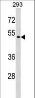P2RX6 / P2X6 Antibody (aa198-226)
