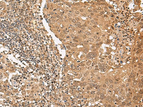 Polyclonal Rabbit anti-Human TIPRL / TIP Antibody (IHC)