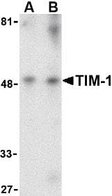 PathPlus™ Polyclonal Rabbit anti-Human HAVCR1 / KIM-1 Antibody (IHC, WB)
